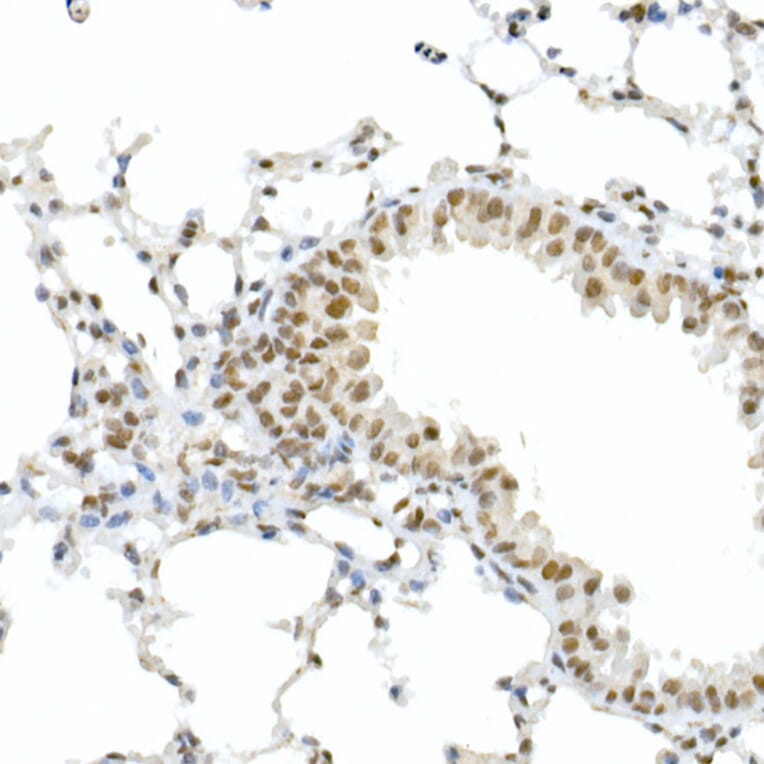 Immunohistochemistry - Anti-Rb (phospho Ser795) Antibody (A16439) - Antibodies.com