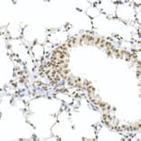 Immunohistochemistry - Anti-Rb (phospho Ser795) Antibody (A16439) - Antibodies.com