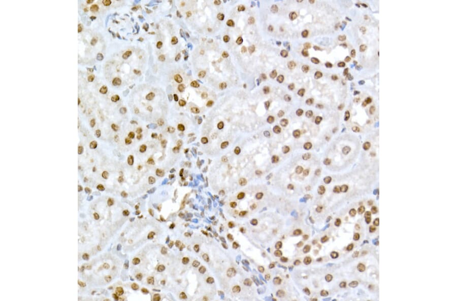 Immunohistochemistry - Anti-Rb (phospho Ser795) Antibody (A16439) - Antibodies.com