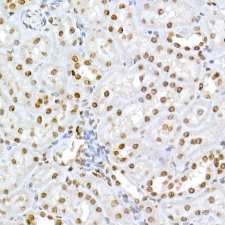 Immunohistochemistry - Anti-Rb (phospho Ser795) Antibody (A16439) - Antibodies.com
