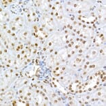 Immunohistochemistry - Anti-Rb (phospho Ser795) Antibody (A16439) - Antibodies.com