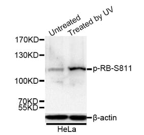 Western Blot - Anti-Rb (phospho Ser811) Antibody (A16440) - Antibodies.com