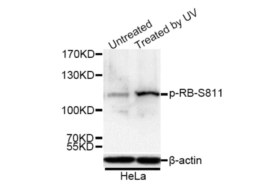 Western Blot - Anti-Rb (phospho Ser811) Antibody (A16440) - Antibodies.com