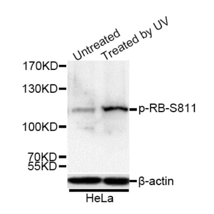 Western Blot - Anti-Rb (phospho Ser811) Antibody (A16440) - Antibodies.com