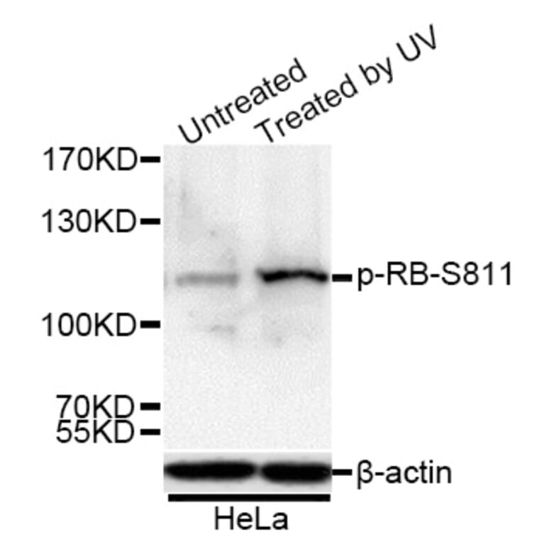 Western Blot - Anti-Rb (phospho Ser811) Antibody (A16440) - Antibodies.com