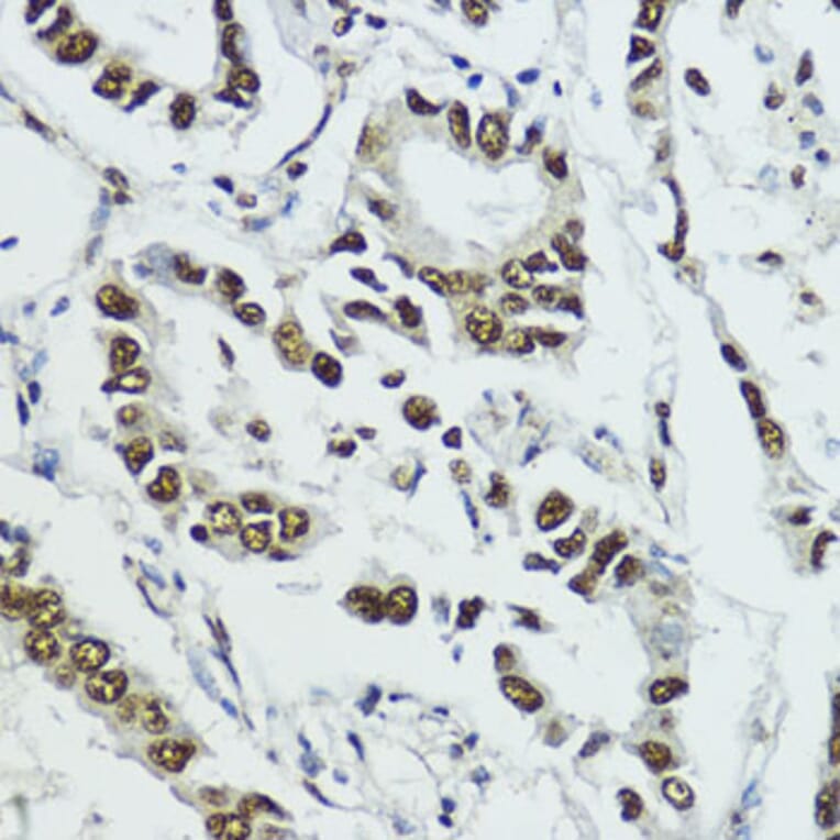 Immunohistochemistry - Anti-Histone H3 (phospho Thr11) Antibody (A16441) - Antibodies.com