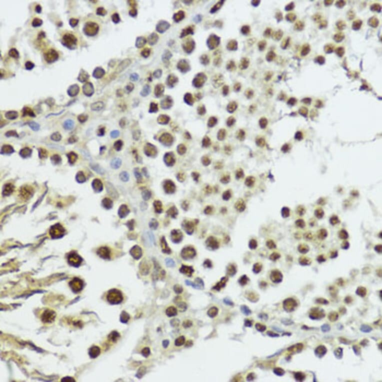 Immunohistochemistry - Anti-Histone H3 (phospho Thr11) Antibody (A16441) - Antibodies.com