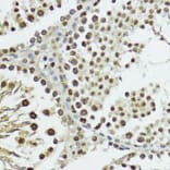 Immunohistochemistry - Anti-Histone H3 (phospho Thr11) Antibody (A16441) - Antibodies.com