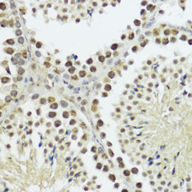 Immunohistochemistry - Anti-Histone H3 (phospho Thr11) Antibody (A16441) - Antibodies.com