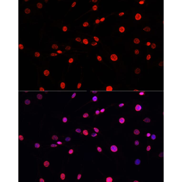 Immunofluorescence - Anti-Histone H3 (phospho Thr11) Antibody (A16441) - Antibodies.com