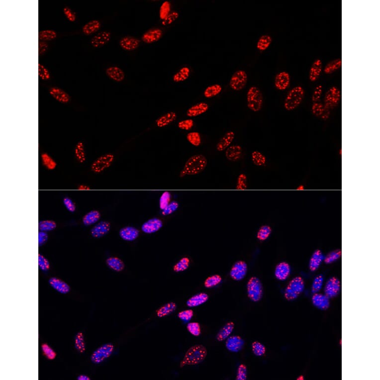 Immunofluorescence - Anti-Histone H3 (phospho Thr11) Antibody (A16441) - Antibodies.com