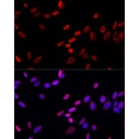 Immunofluorescence - Anti-Histone H3 (phospho Thr11) Antibody (A16441) - Antibodies.com