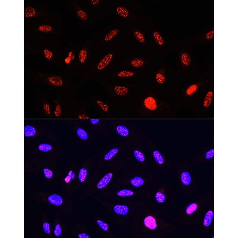 Immunofluorescence - Anti-Histone H3 (phospho Thr11) Antibody (A16441) - Antibodies.com