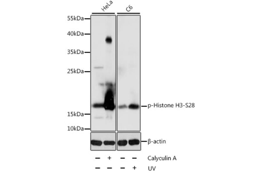 Western Blot - Anti-Histone H3 (phospho S28) Antibody (AP0097) - Antibodies.com