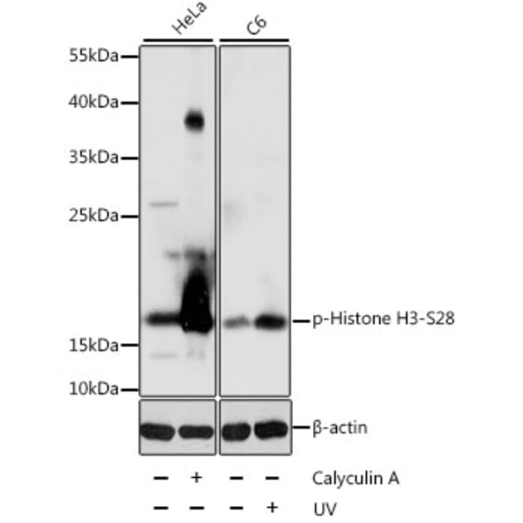 Western Blot - Anti-Histone H3 (phospho S28) Antibody (AP0097) - Antibodies.com