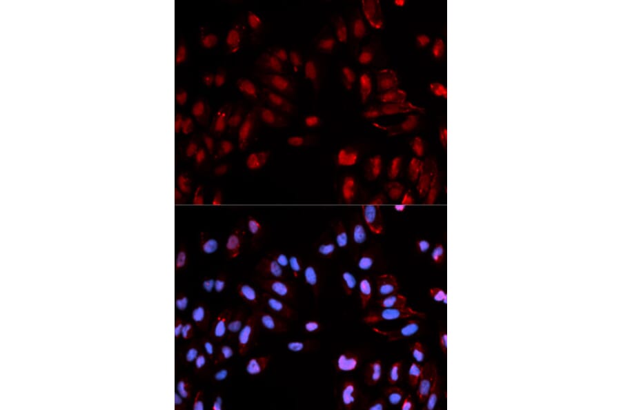 Immunofluorescence - Anti-Histone H3 (phospho S28) Antibody (AP0097) - Antibodies.com