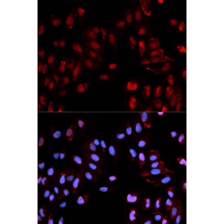 Immunofluorescence - Anti-Histone H3 (phospho S28) Antibody (AP0097) - Antibodies.com