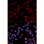 Immunofluorescence - Anti-Histone H3 (phospho S28) Antibody (AP0097) - Antibodies.com