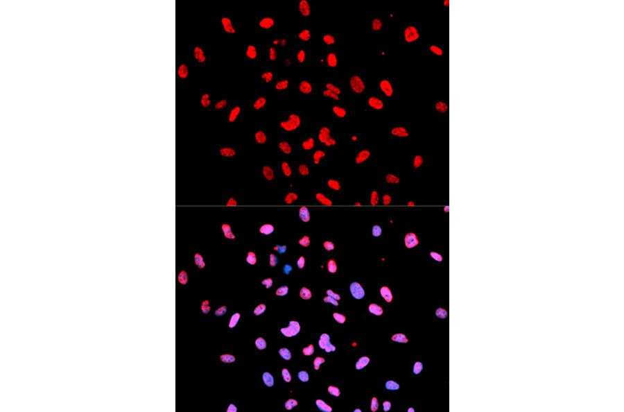 Immunofluorescence - Anti-Btk (phospho Y223) Antibody (AP0100) - Antibodies.com