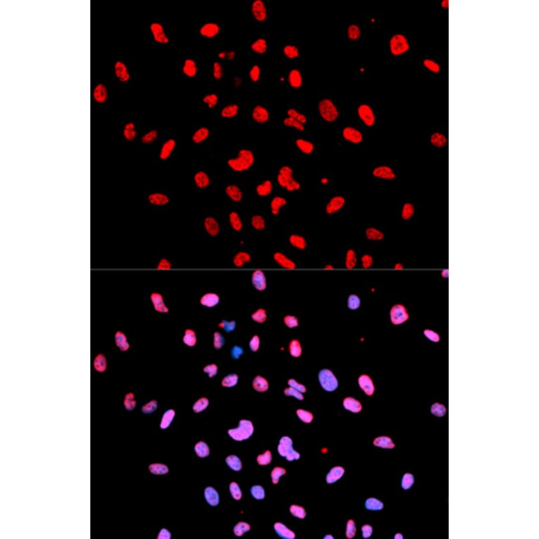 Immunofluorescence - Anti-Btk (phospho Y223) Antibody (AP0100) - Antibodies.com