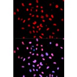 Immunofluorescence - Anti-Btk (phospho Y223) Antibody (AP0100) - Antibodies.com