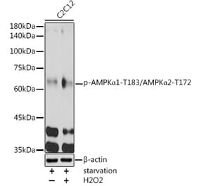 Western Blot - Anti-AMPK alpha 1 + AMPK alpha 2 (Phospho T183 & Phospho T172) Antibody (A16447) - Antibodies.com