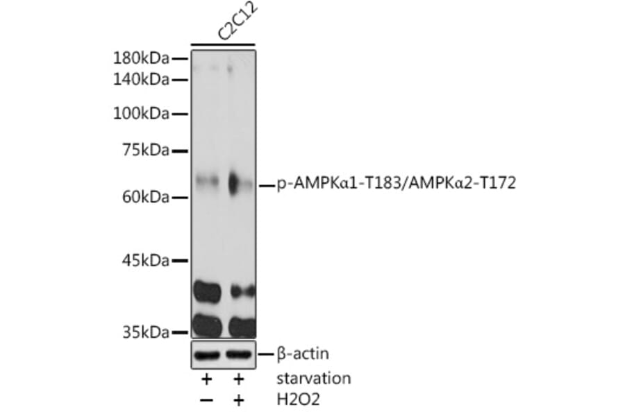 Western Blot - Anti-AMPK alpha 1 + AMPK alpha 2 (Phospho T183 & Phospho T172) Antibody (A16447) - Antibodies.com