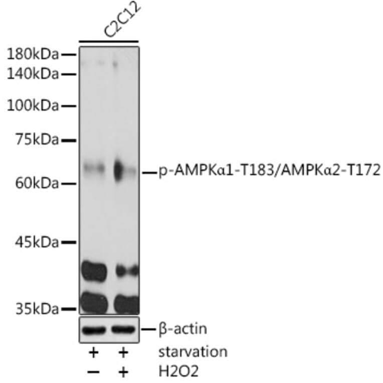 Western Blot - Anti-AMPK alpha 1 + AMPK alpha 2 (Phospho T183 & Phospho T172) Antibody (A16447) - Antibodies.com