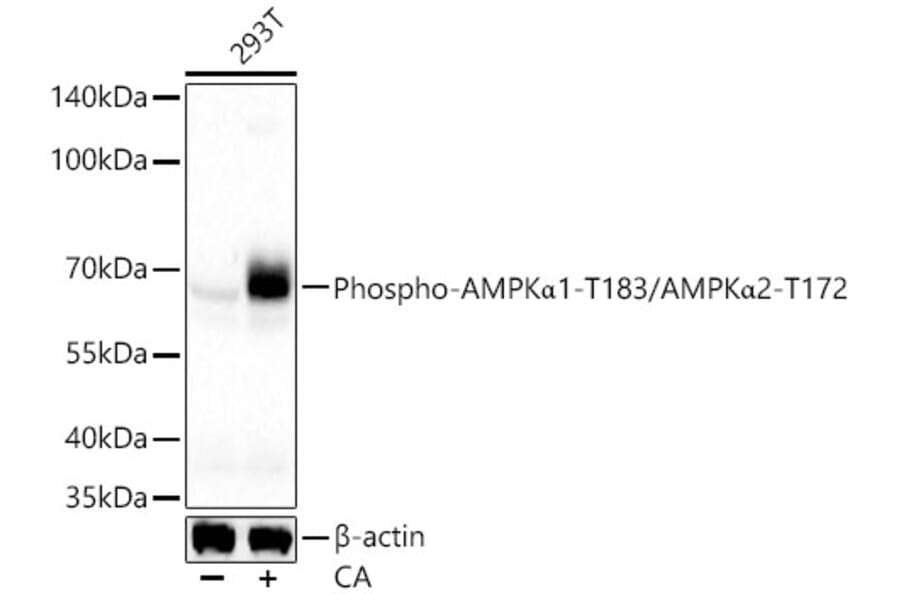 Western Blot - Anti-AMPK alpha 1 + AMPK alpha 2 (Phospho T183 & Phospho T172) Antibody (A16447) - Antibodies.com