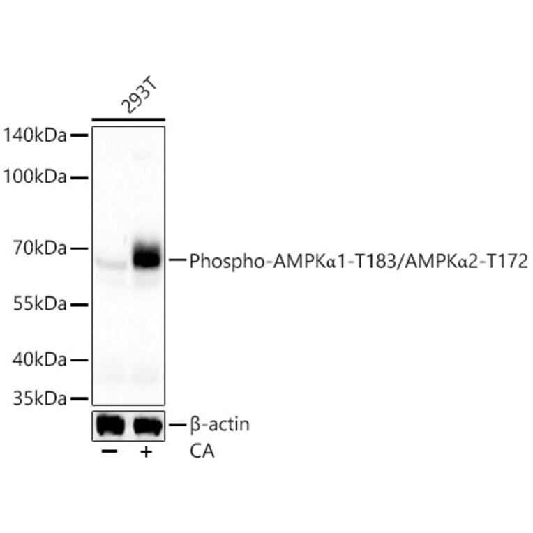 Western Blot - Anti-AMPK alpha 1 + AMPK alpha 2 (Phospho T183 & Phospho T172) Antibody (A16447) - Antibodies.com