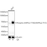 Western Blot - Anti-AMPK alpha 1 + AMPK alpha 2 (Phospho T183 & Phospho T172) Antibody (A16447) - Antibodies.com