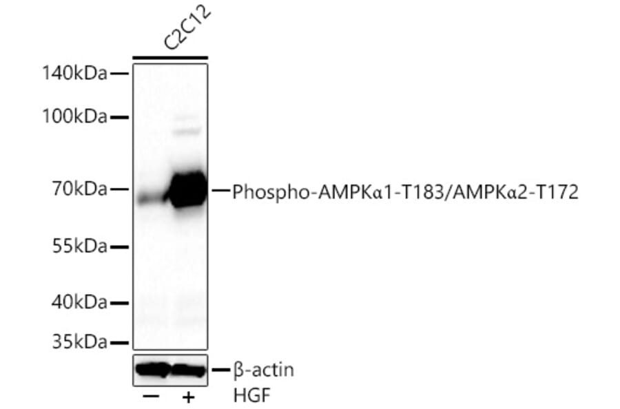 Western Blot - Anti-AMPK alpha 1 + AMPK alpha 2 (Phospho T183 & Phospho T172) Antibody (A16447) - Antibodies.com