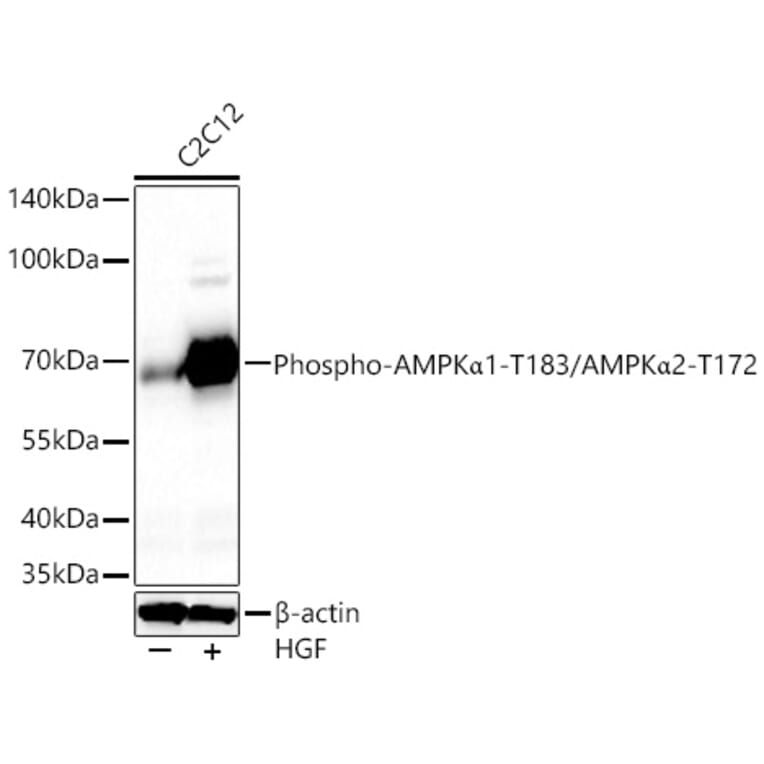 Western Blot - Anti-AMPK alpha 1 + AMPK alpha 2 (Phospho T183 & Phospho T172) Antibody (A16447) - Antibodies.com