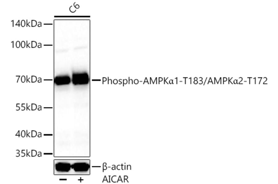 Western Blot - Anti-AMPK alpha 1 + AMPK alpha 2 (Phospho T183 & Phospho T172) Antibody (A16447) - Antibodies.com
