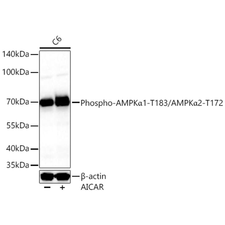 Western Blot - Anti-AMPK alpha 1 + AMPK alpha 2 (Phospho T183 & Phospho T172) Antibody (A16447) - Antibodies.com