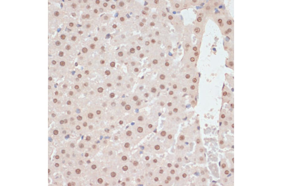 Immunohistochemistry - Anti-AMPK alpha 1 + AMPK alpha 2 (Phospho T183 & Phospho T172) Antibody (A16447) - Antibodies.com