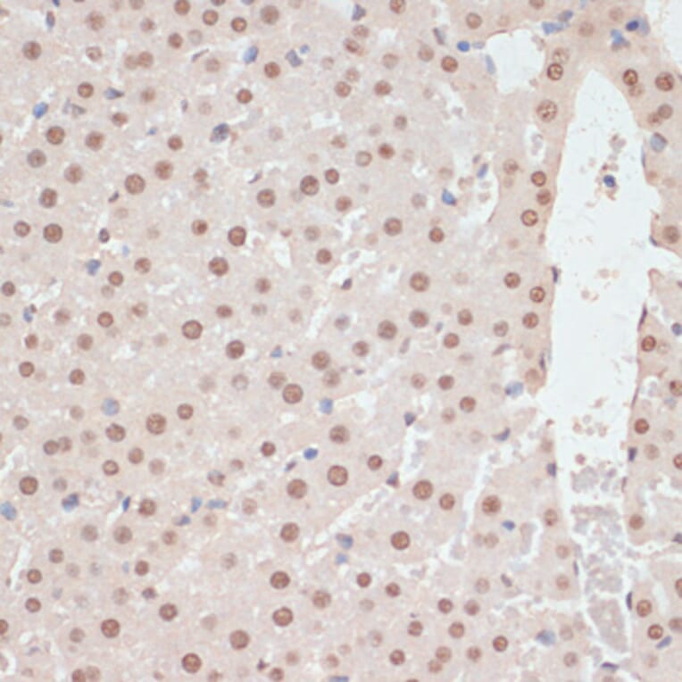 Immunohistochemistry - Anti-AMPK alpha 1 + AMPK alpha 2 (Phospho T183 & Phospho T172) Antibody (A16447) - Antibodies.com