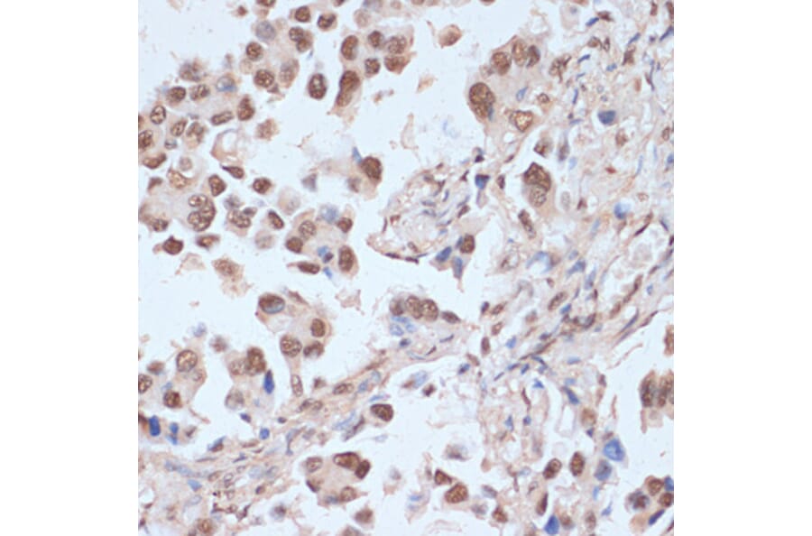 Immunohistochemistry - Anti-AMPK alpha 1 + AMPK alpha 2 (Phospho T183 & Phospho T172) Antibody (A16447) - Antibodies.com