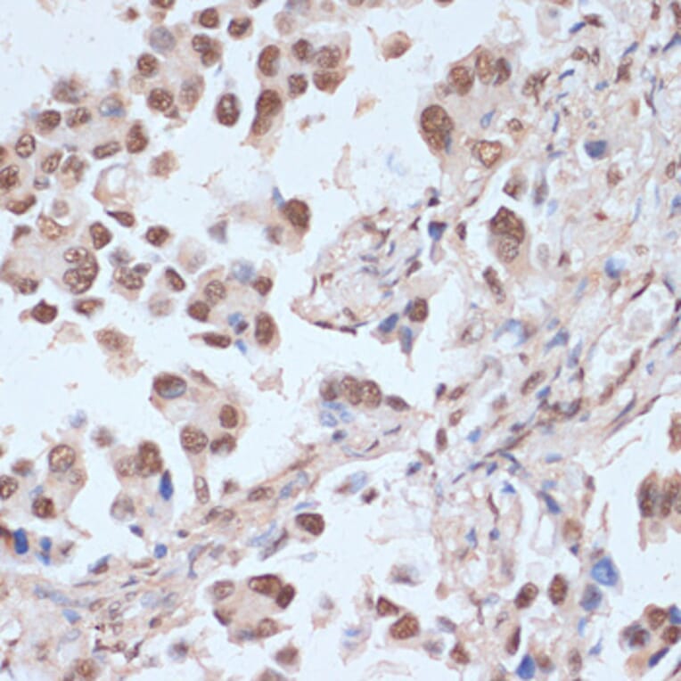 Immunohistochemistry - Anti-AMPK alpha 1 + AMPK alpha 2 (Phospho T183 & Phospho T172) Antibody (A16447) - Antibodies.com