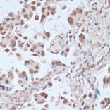Immunohistochemistry - Anti-AMPK alpha 1 + AMPK alpha 2 (Phospho T183 & Phospho T172) Antibody (A16447) - Antibodies.com