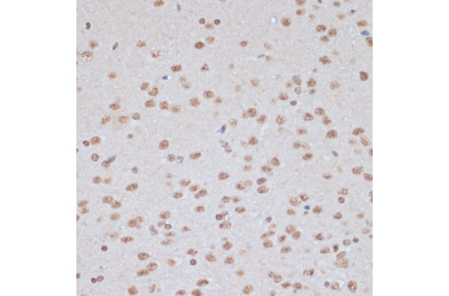 Immunohistochemistry - Anti-AMPK alpha 1 + AMPK alpha 2 (Phospho T183 & Phospho T172) Antibody (A16447) - Antibodies.com