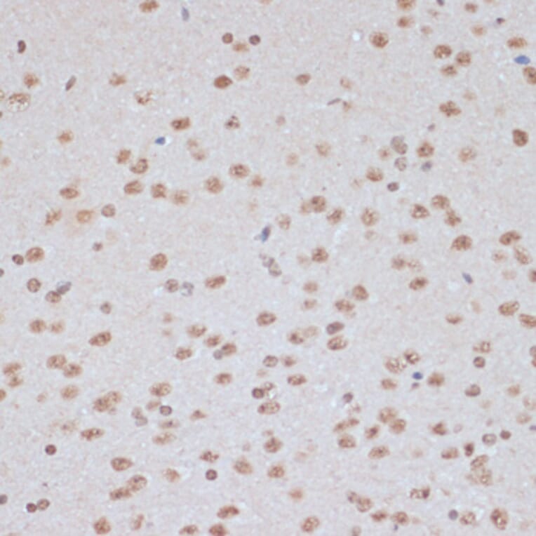 Immunohistochemistry - Anti-AMPK alpha 1 + AMPK alpha 2 (Phospho T183 & Phospho T172) Antibody (A16447) - Antibodies.com