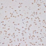 Immunohistochemistry - Anti-AMPK alpha 1 + AMPK alpha 2 (Phospho T183 & Phospho T172) Antibody (A16447) - Antibodies.com