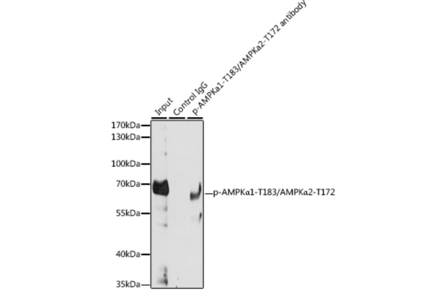 Immunoprecipitation - Anti-AMPK alpha 1 + AMPK alpha 2 (Phospho T183 & Phospho T172) Antibody (A16447) - Antibodies.com