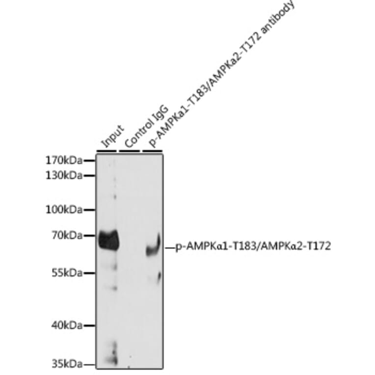 Immunoprecipitation - Anti-AMPK alpha 1 + AMPK alpha 2 (Phospho T183 & Phospho T172) Antibody (A16447) - Antibodies.com