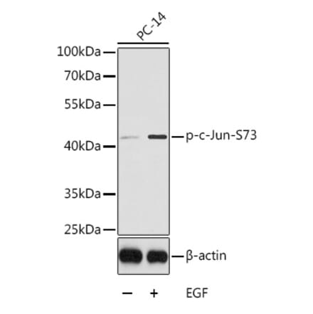 Western Blot - Anti-c-Jun (phospho Ser73) Antibody (A16448) - Antibodies.com