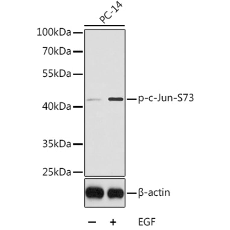 Western Blot - Anti-c-Jun (phospho Ser73) Antibody (A16448) - Antibodies.com