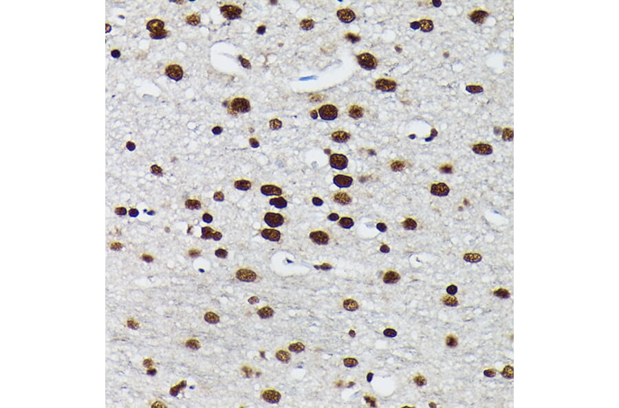 Immunohistochemistry - Anti-c-Jun (phospho Ser73) Antibody (A16448) - Antibodies.com
