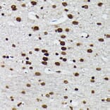 Immunohistochemistry - Anti-c-Jun (phospho Ser73) Antibody (A16448) - Antibodies.com