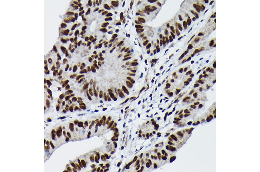 Immunohistochemistry - Anti-c-Jun (phospho Ser73) Antibody (A16448) - Antibodies.com